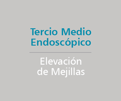 Tercio Medio Endoscópico