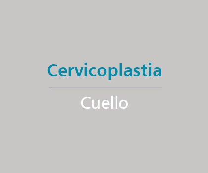 Cervicoplastia